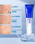 Pair Acne Cream 24g